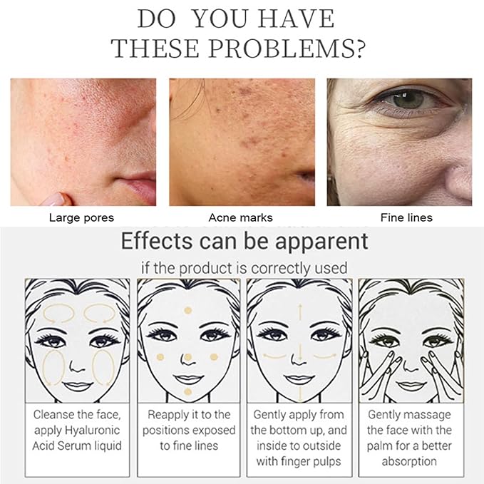 AICHUN BEAUTY Face Serum Eye Essence Anti-Wrinkles Anti-Acne Oil-Control Anti-Freckle Refreshing Moisturizing Purifying Shrink Pores 30ml 1.01FL.oz (Niacinamide10% + Zinc 1% Face Serum)