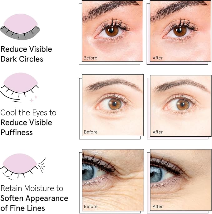 grace & stella Under Eye Patches (12 pairs) - Birthday Gifts for Women - Travel Essentials - Eye Masks for Puffy Eyes and Dark Circles - Anniversary Gifts for Her, Bachelorette Party Favors - Vegan