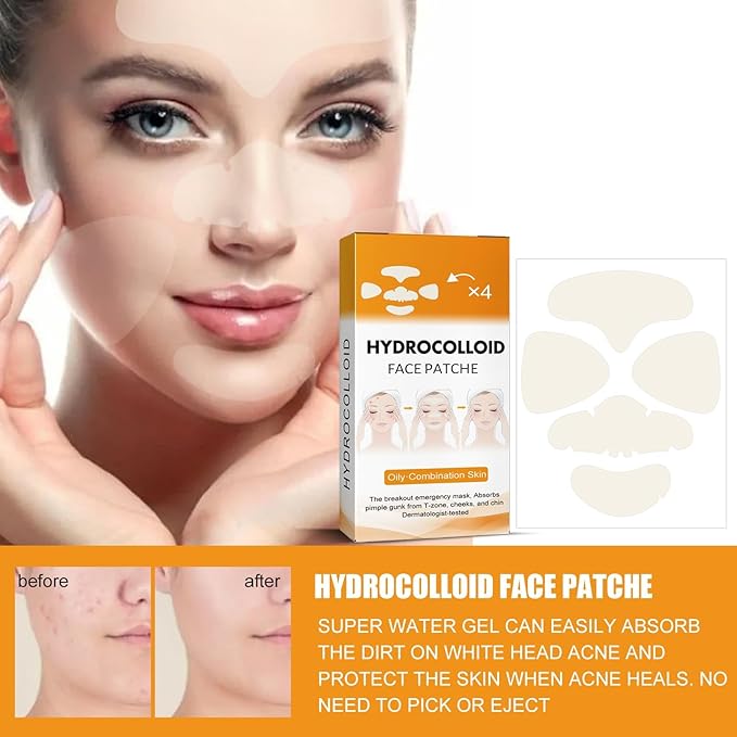 40Pcs Hydrocolloid Acne Patches Full-Face Coverage Kit for Pimples & Blemishes, Skin Care Solution for Clearing Spots