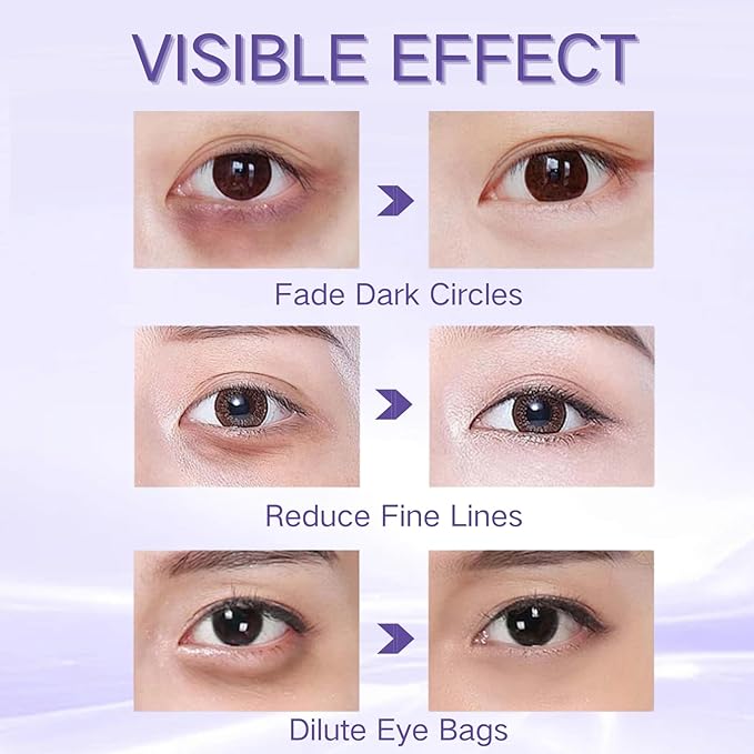 Eye Cream for Dark Circles and Puffiness - Retinol Eye Cream Anti Aging -Ey e Bags Treatment for Women - Caviar Eye Se rum for Wrinkles - Moisturizing under Eye Cream -Ey e Serum with 360°Massage Ball