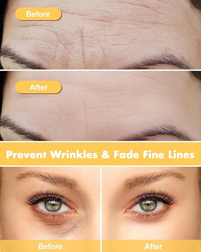 Silicone Forehead Wrinkle Patch - Non-Glue Reusable Forehead Wrinkle Patch and Eye Patches Set, Silicone Patches for Wrinkles, For Use with Face Cream or Lotion, Metal Eye Massage Stick&Tin Case, Gold