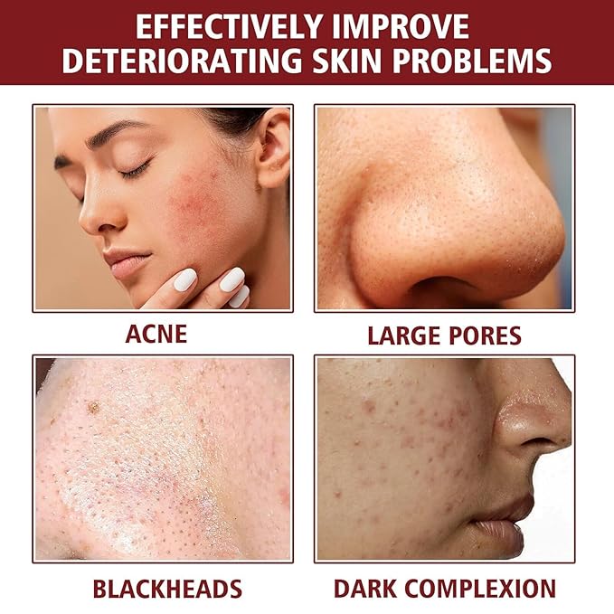 AHA 30% + BHA 2% Peeling Solution, Chemical Peel for Face at Home, BHA Liquid Exfoliant for Large Pores, Wrinkles & Fine Lines, 1.0 Floz (1 PCS)