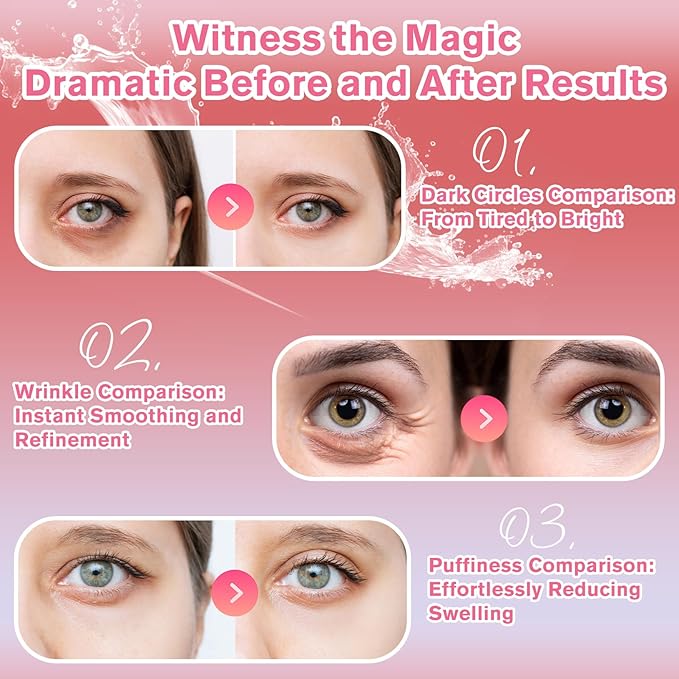 Rose Eye Patches 2-Pack (120 PCS), Hydrating & Soothing Eye Mask Skincare, Anti-Aging Collagen Eye Gel, Under Eye Patches for Puffiness | Alcohol-free & Phthalates-free