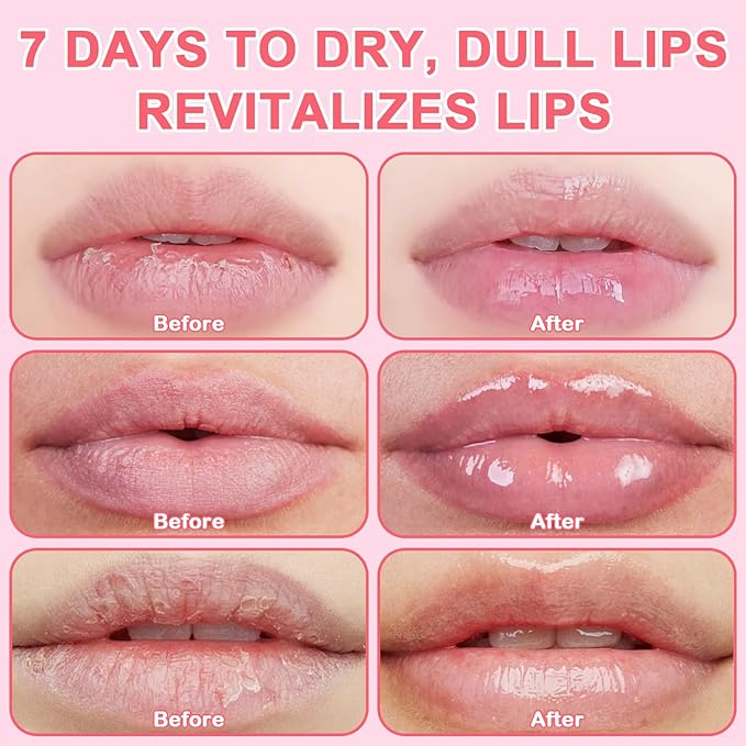 Lip Therapy Set - Lip Scrub & Lip Mask, Overnight Treatment Lip Care Kits with - Exfoliate, Condition, Hydrate and Soothe, Exfoliator & Moisturize Natural Two Step Treatment(4PCS)