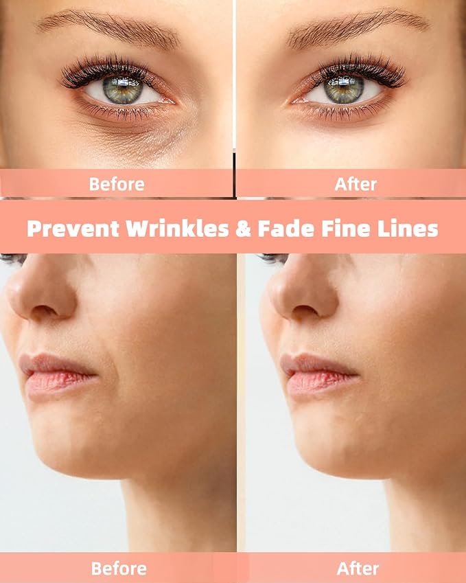 Reusable Eye and Smile Line Patches - 4 Pairs Silicone Under Eye Patches and Nasolabial Folds Patches, Reusable Eye Mask, Silicone Wrinkle Patches for Eye Lines & Smile Lines Treatment, No Adhesive