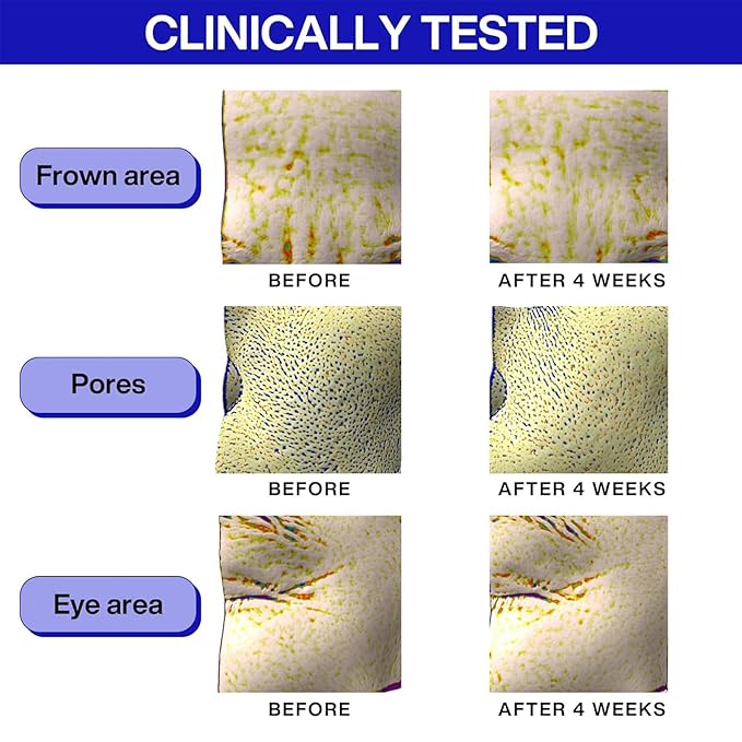 IOPE Retinol Super Bounce Serum | Korean Retinoid Eye Treatment for Anti-Aging, Beginner Friendly, Reduction in Fine Lines & Wrinkles, Firming and Rejuvenating, Daily Glow Routine, 1.69 Fl Oz. (50ml)