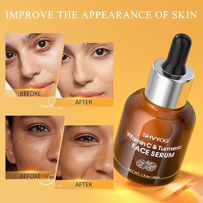 Vitamin C Face Serum with Turmeric for Uneven Skin Tone, Vitamin C & Turmeric Serum for Anti-Aging, Hydrating and Improving Dull Skin 1 Fl Oz