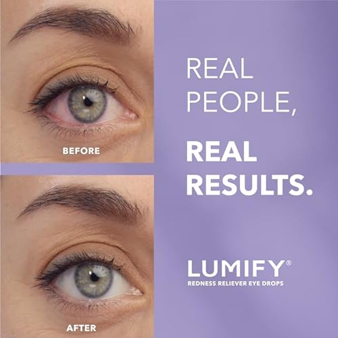 LUMIFY Redness Reliever Eye Drops, For Whiter & Brighter Looking Eyes, 0.17 Fl Oz (5 mL)