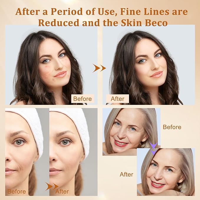 Hotodeal LED Face Mask Light Therapy,7 Colors Light Therapy for Skin Rejuvenation Anti-aging Beauty Red Light Therapy,Silicone Material LED Mask Foldable for Easy Carrying,Silicone Version