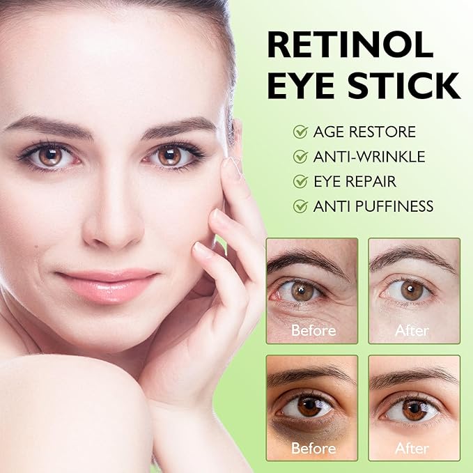 Retinol Eye Stick Retinol Eye Cream Brightening Eye Balm Reduces Fine Lines and Dark Circles Visible Results Anti-Wrinkle Hydrating Eye Stick in 3-4 Weeks