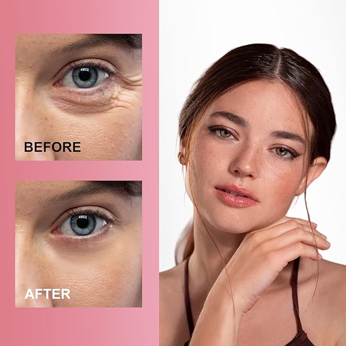 Reusable Wrinkle Patches 3 Pack - Silicone Fusion Treatment Forehead Patches for Brow Lift, Wrinkle Smoothers, Reduce Frown Lines & Face Lift (Eye)