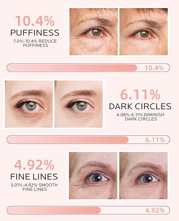 Dr. Pure Under Eye Patches for Puffiness: Dark Circles and Puffy Eyes Treatment Caffeine Eye Mask with Niacinamide Hyaluronic Acid - Smooth Wrinkles Reduce Eye Bags Undereye Gel Pad (30 Pairs)