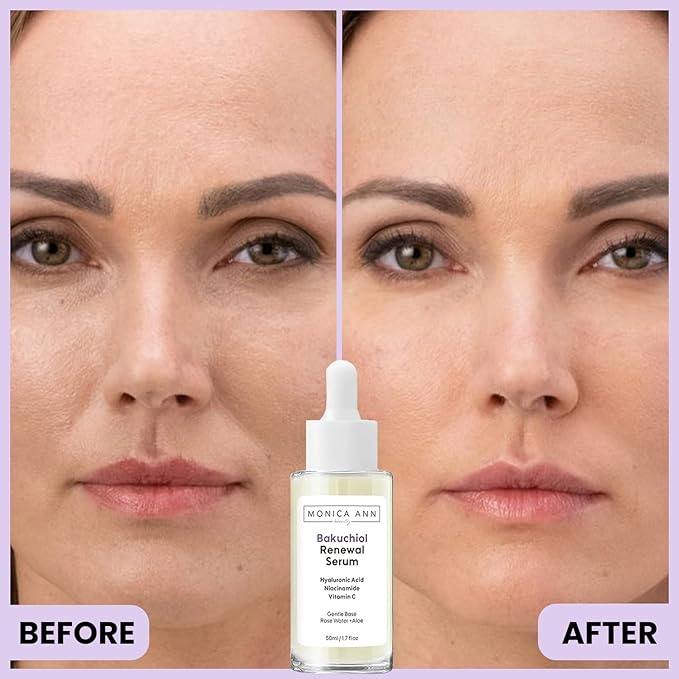 Bakuchiol Renewal Serum with Hyaluronic Acid, Niacinamide, and Vitamin C, 50ml