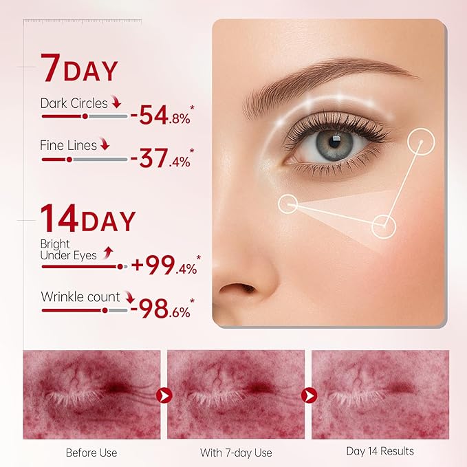 Peunitory Eye Balm, Under Eye Cream Brightener Balm Stick For Wrinkles Dark Circle Treatment Moisturizing Relief Skin Elasticity 0.32oz/9g