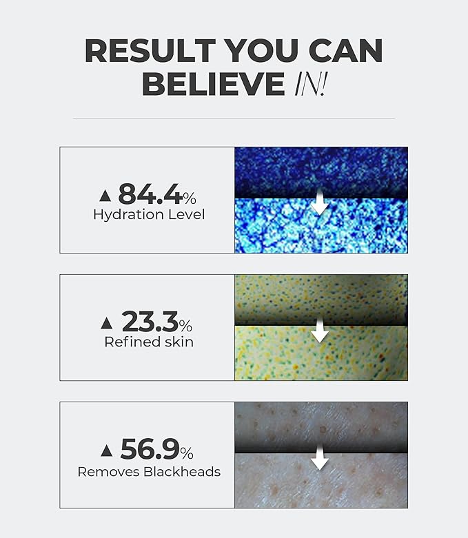 Charcoal Cleansing Balm, All in One Nourishing, Hydrating Makeup Melting Remover for Dry & Sensitive Skin, Korean Beauty Face Wash Cleanser 3.38 fl.oz