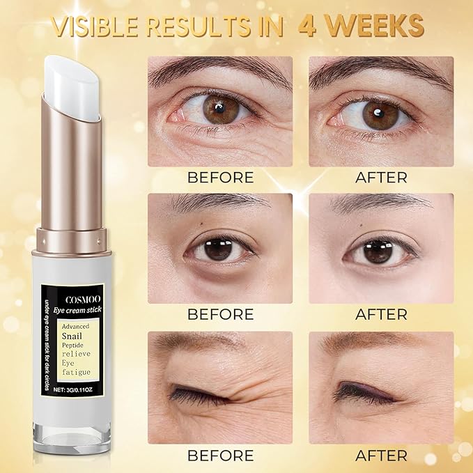 COSMOO Snail Peptide Advanced Under Eye Cream for Dark Circles, With Snail Mucin, Advanced Snail Eye Stick For Puffiness & Bags, Reduce Wrinkles, Fine Lines, Moisturizating Skin