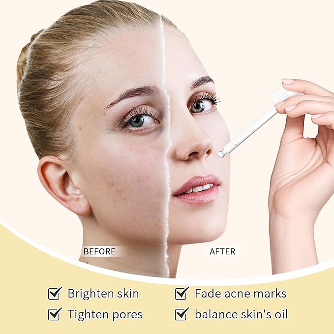 Niacinamide 10% + Zinc 1% Face Serum For Women,Niacinamide Hydrating Serum with Hyaluronic Acid for Oil Control & Anti Acne, 30 ml Anti Aging Niacinamide Serum for Skin Barrier Repair,2Pcs