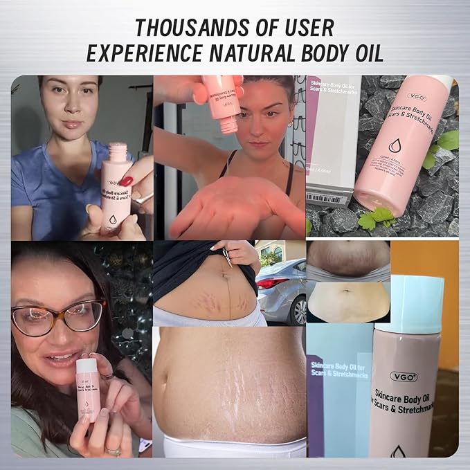 VGO Body Oil with Vitamin E, After Shower Body Oil for Women, Non-Greasy & Fast-Absorbing Lightweight Moisturizer for Scars & Stretch Marks, Hydrating for Dry Sensitive Skin