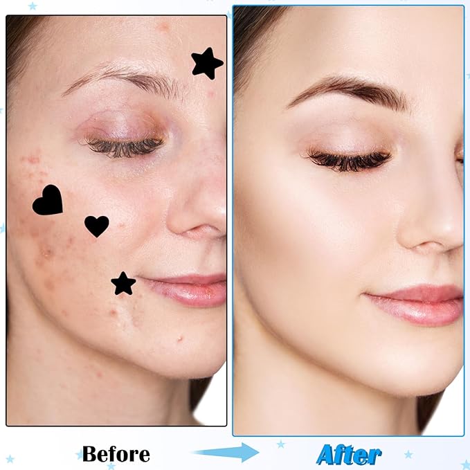288pcs Pimple Patch Star, 2 Styles Star Pimple Patch, Cute Black Pimples Patches Stars, Skin-friendly, Breathable, Waterproof,for Covering Acne,for Makeup, Sleep, Wedding and Festival
