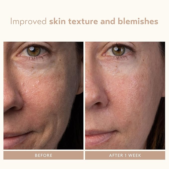 SHANI DARDEN SKIN CARE Lactic Acid Face Serum Travel Size, Active Night Serum to Help with the Look of Radiant and Smooth Skin, Gentle But Powerful Face Exfoliator, 0.34 fl oz