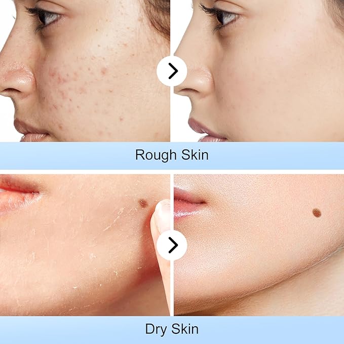 Boobeen 6 Animal Hydrating Face Mask Set, Sheet Face Mask Skincare to Moisturizing Skin, Holiday Present Pack Facial Mask Skincare, Face Skin Treatment Mask for All Skin Types