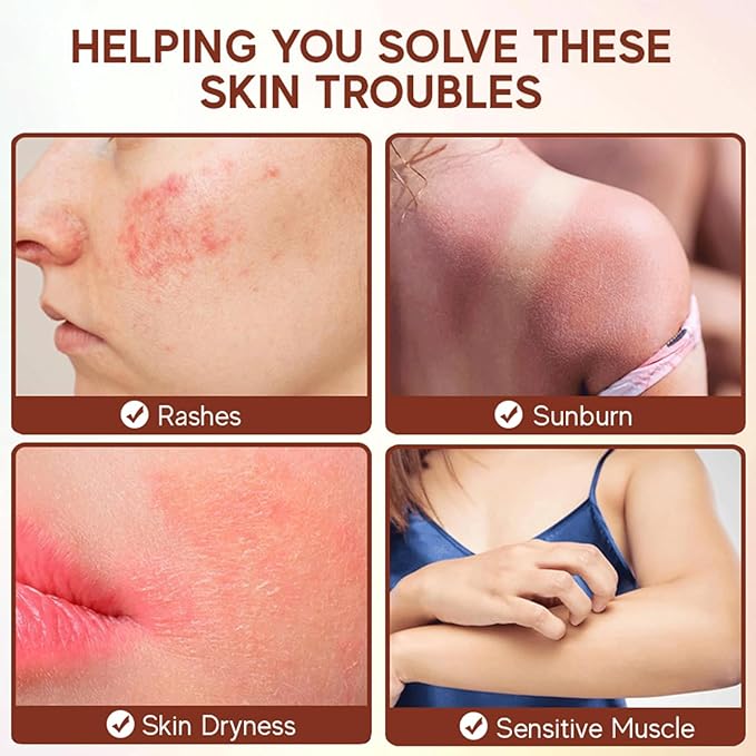 Grass Fed Beef Tallow for Skin Care, Whipped Beef Tallow for Skin, Beef Tallow Face Moisturizer Beef Tallow Cream Natural Organic Moisturizing Cream for Face & Body Lotion Skin Care for Sensitive Skin