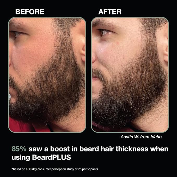 ZEUS BeardPLUS Conditioner for Men, Premium Beard Wash for Enhanced Growth, Thicker & Stronger Facial Hair with Biotin & Caffeine (Made in USA) 6 oz.