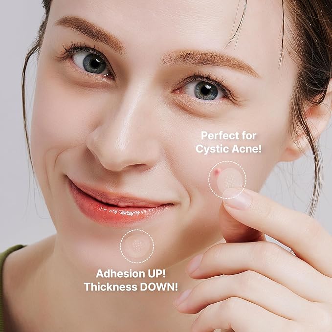 ACROPASS Acne Cure DEN Microarray Patch, OTC Salicylic Acid 2% (4ct) – Acne Treatment for Sensitive Skin, Anti-Inflammation