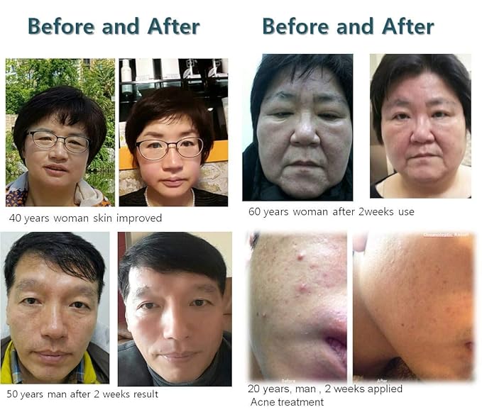 [Serment] Korean Cosmetics Serment Peptide and Stem Cell Serum 30ml with Advance Super liposome technology