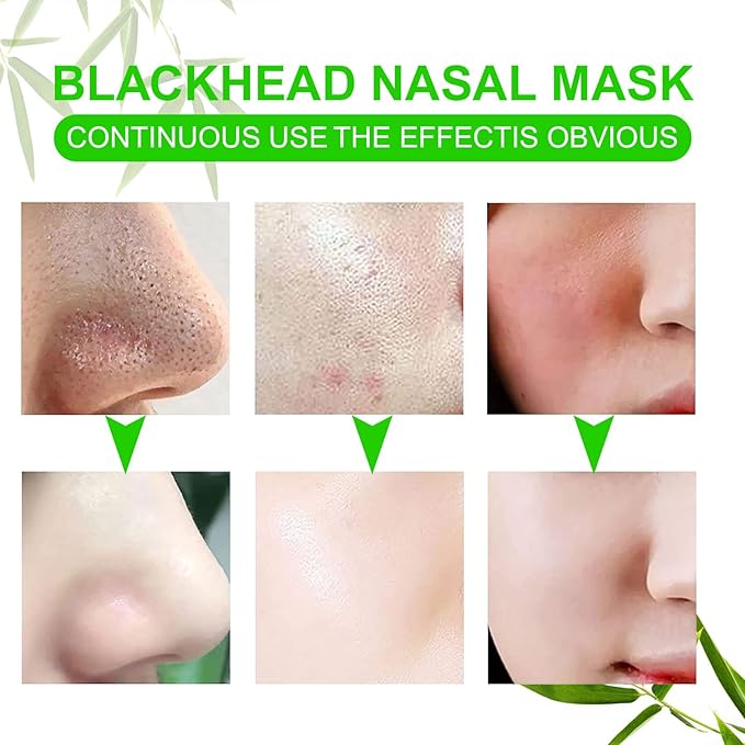 Pore Strips,Blackhead Remover,Black Heads Removal for Nose Face,Deep Cleansing Charcoal Strips,Pore Whiteheads Cleanser Strawberry Nose, Deep Cleansing for All Skin Types