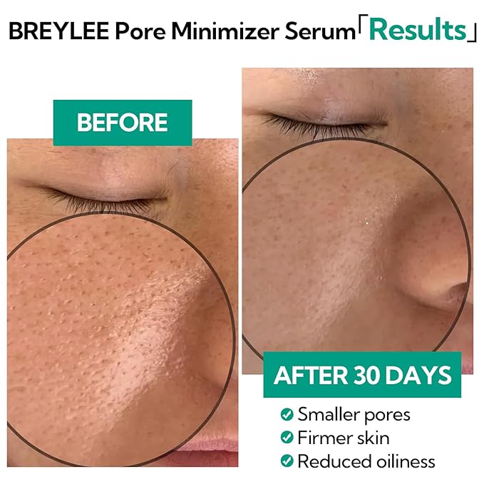 Pore Minimizer Serum， BREYLEE Pore Refining Serum for Face & Nose, Oil Control Firming, Shrinking Pore & Tightening Skin, Pore Moisture after Blackhead Remover, Clam and Soothing Skin Care