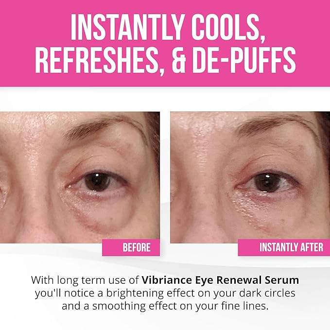 Vibriance Eye Renewal Serum - Dark Circles and Puffiness Treatment - Caffeine Formula for Reducing Bags