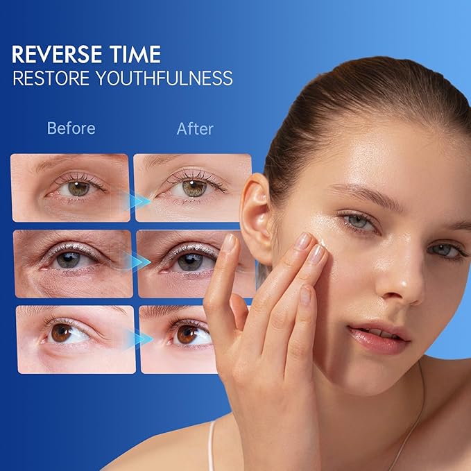 6% Caffeine Eye Cream for Dark Circles - Rapid Wrinkle Repair, Daily 1% Retinol & Hyaluronic Acid to Fight Fine Lines, Wrinkles, & Dark Spots, Eye Care Suitable for Men and Women's 0.68 fl. oz