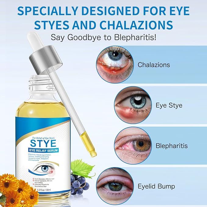 Stye Eye Treatment, Natural Stye Relief Serum for Styes, Chalazions and Blepharitis, Quickly Relieves Eye Irritation and Restores Healthier Skin