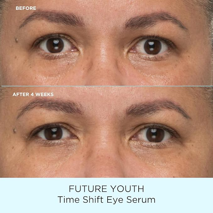 Pacifica Future Youth Time Shift Eye Serum – Peptide Eye Serum for Fine Lines & Dark Circles, Lifting & Firming Under Eye Treatment w/Flora + Peptide-11, Unscented Hydrating Gel for All Skin Types