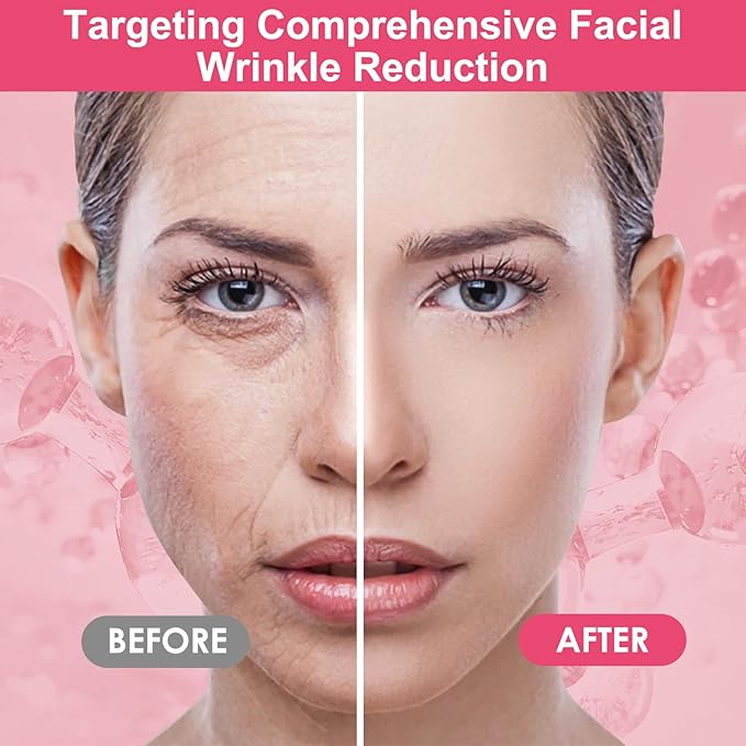 16 PCS Reusable Face Wrinkle Patches Kit | Face Patches for Wrinkles Overnight | Anti Wrinkle Patches | Facial Patches for Wrinkles | Forehead Wrinkle Patches | Face Lift Tape