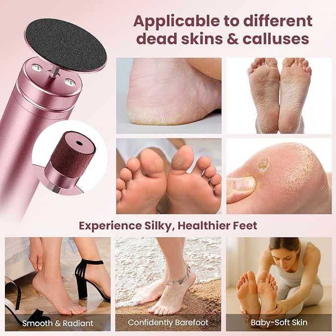 Electric Callus Remover for Feet, Adjustable Speed Foot Callus Remover, Professional Pedicure Tools for Feet with 60 Pcs Replacement Sandpaper Disc, Foot Scrubber for Dead Skin and Calluses