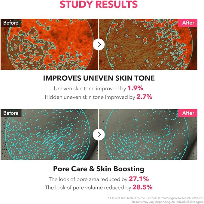 APRILSKIN TXA Niacinamide Toning Shot 99 Spicule Facial Serum｜Skin Booster Serum｜99% High-Purity Tranexamic Acid 3% + Niacinamide 5% for Uneven Skin Tone, Pore Care｜Korean Skin Care｜1.01 fl. oz.