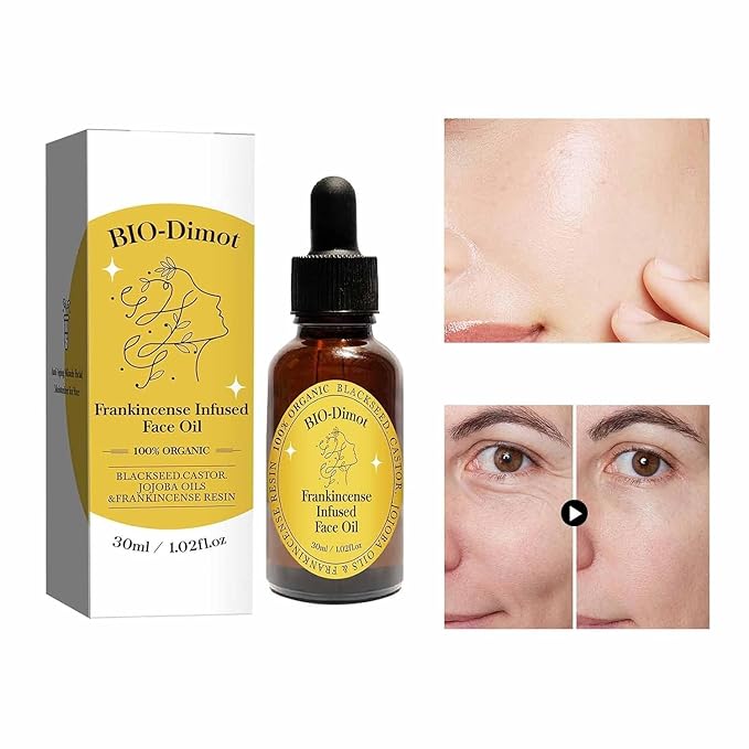 Frankincense Resin Oil For Face，Frankincense Resin Infused Organic Black Seed & Jojoba Oils,Natural skin Care moisturizing, Facial Anti-Aging Moisturizing skin Serum (2)
