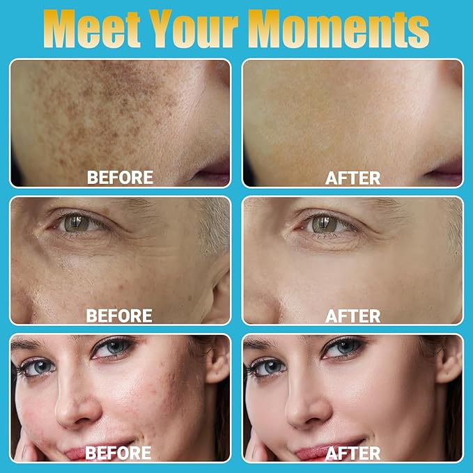 Home Use Microneedling Microneedle Skin Care Beauty Kit Tool for Face Hair Beard