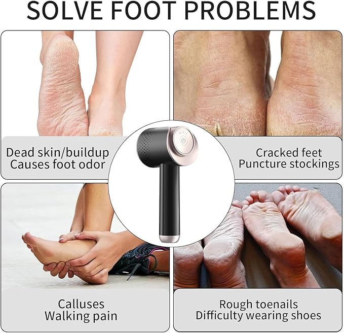 Electric Foot Callus Remover, Rechargeable Foot File Callus Remover for Feet, Portable Foot Scrubber with 10in1 Pedicure Tools for Feet Cracked Heel Dead Skin, 6 Rollers, 3 Speed
