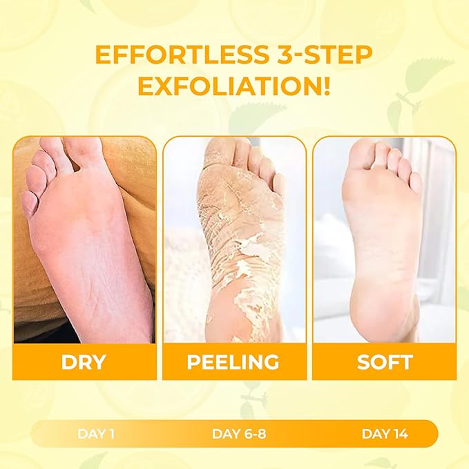 Happy Feet Foot Peel Mask, Original Exfoliate Foot Mask, Callus Remover for Rough Cracked Dry Feet Dead Skin, Lemon 03 Packs