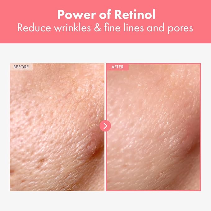 Repair Retinol Cream, Liposomal Retinol 0.1%, Bakuchiol, Retinal, niacinamide, Anti Aging for Face, Eye, Fine Lines & Wrinkles Treatment, Pure Vitamin A, Korean Skincare, 50g, 1.76 oz.