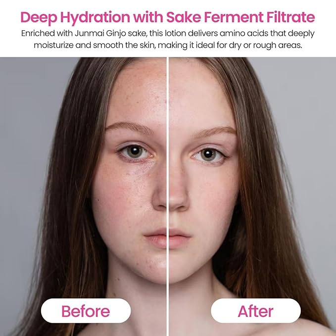 Daily Face Moisturizer for Dry & Sensitive Skin Women & Men, Moisturizing Anti-Aging Facial Toner Lotion, Organic Japanese Fermented Rice, Sake Extract& Amino Acids, 16.9 Fl Oz HIGH MOIST