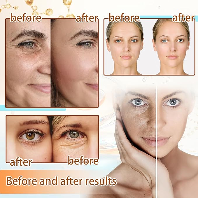 Collagen Anti-Wrinkle Mask 10P