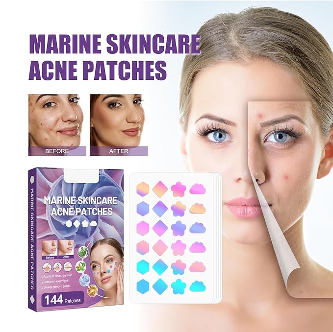 144 PCS Acne Patches Cute Pimple Patches for Face and Skin - Hydrocolloid Acne Treatment Dots to Cover and Reduce Zits, Blemishes, Spots, Star Pimple Patch