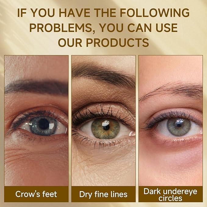 Instant Eye Tightener, Under Eye Bags and Wrinkles Filler, Temporary Instant Visibly Reduces Wrinkles Dark Circles Fine Lines Tightening and Lifting Cream for Women Men, 30ml