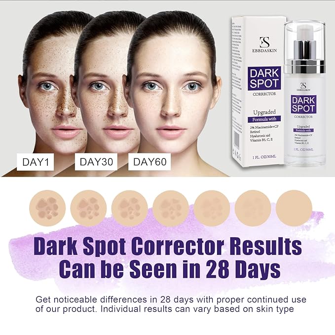 [Upgraded] Dark Spot Remover for Face, Dark Spot Correcting Glow Serum with Niacinamide Retinol and Vitamin C, Rapid Skin Brown Spot Remover, Sun Spot Age Spot Corrector for Daily Skincare 1FL,OZ/30ML