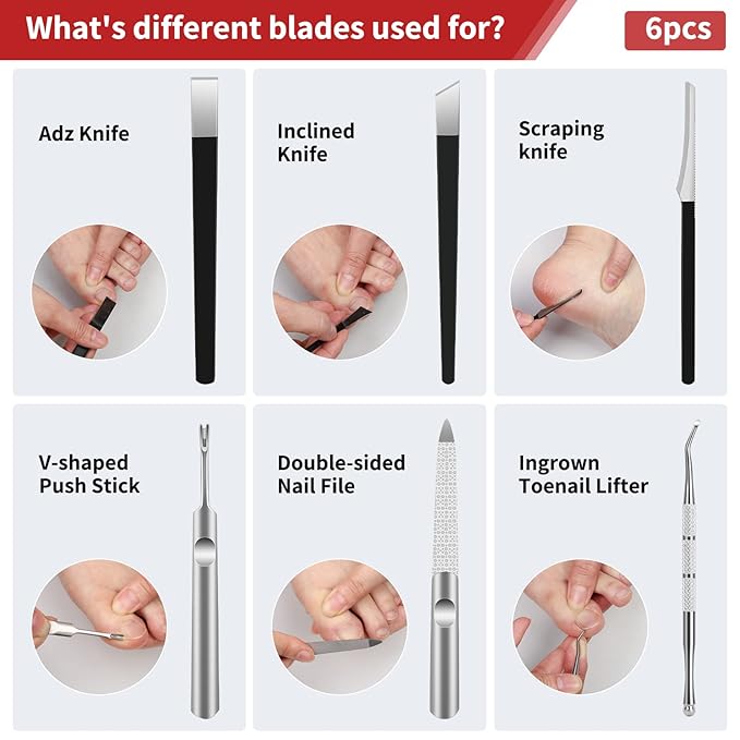 Segbeauty 10pcs Ingrown Toenail Tool, Nail Clippers Pedicure Knife Set Ingrown Toenail Removal Kit, High Manganese Steel Ingrown Toenail Treat-Ment Corrector Tool Blade for Cuticle Remove