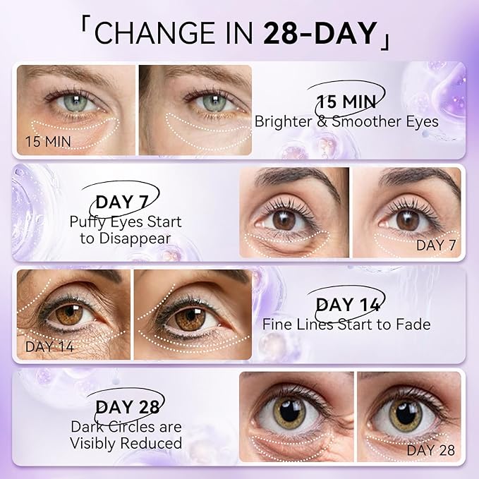 LANBENA Retinol Under Eye Patches for Dark Circles and Puffy Eyes, Cooling Eye Masks for Eye Bags, Fine Lines & Wrinkles Reduce, Anti-Aging, Hydra-Gel Collagen-30 Pairs